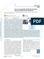 Design and Fabrication of A Customized Partial Hip Prosthesis