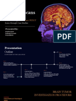 Brain Tumor Pet-Ct Scans Case Studies