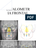 Cefalometria Frontal