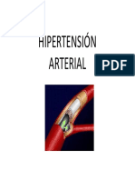 Hipertensión Arterial