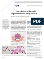 Clinical Review: How to investigate a patient with suspected interstitial lung disease