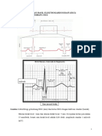 Interpretasi EKG