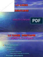 LA CARIE Aspects Cliniques