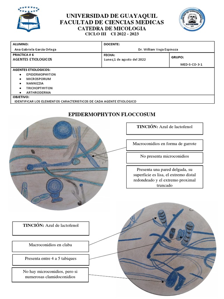 Practica O6 Agentes Etiologicos De Dermatofitosis Epidermophyton 