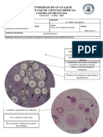 Practica 12 - Paracoccidioides Brasiliensis Blastomyces Dermatitis Coccidioides Immitis - Dibujos