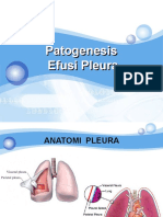 Efusi Pleura