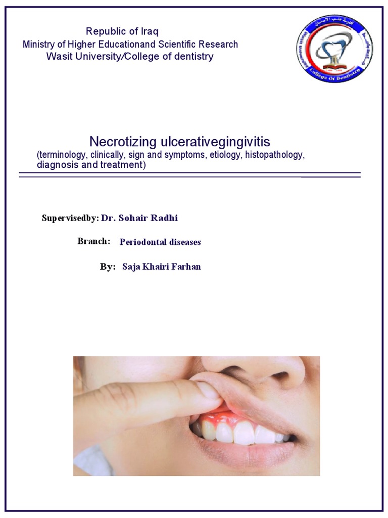 Diagnosing and Treating Necrotizing Ulcerative Gingivitis A Case