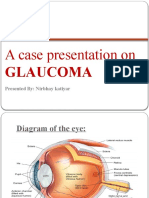A Case Presentation On GLAUCOMA.