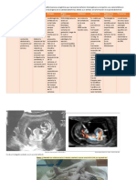 Cuadro Defectos de Pared Abdominal