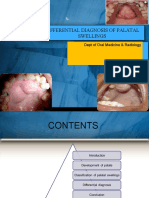 Differential Diagnosis of Palatal Swellings