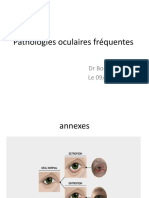 Pathologies Ophtalmologique Fréquentes