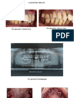 Case Report Implant