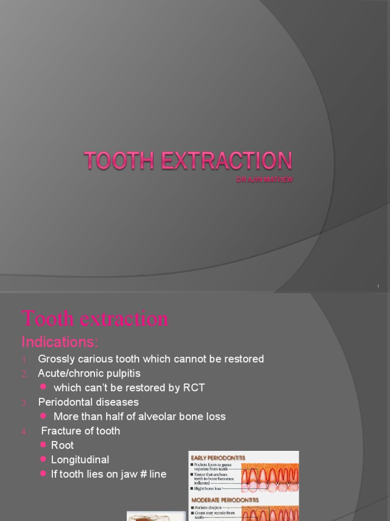 1 Tooth Extraction PDF Mouth Dentistry