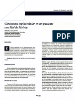 Carcinoma espinocelular asociado con Mal de Meleda