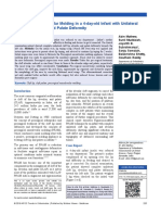 Presurgical Nasoalveolar Molding in A 4-Day-Old Infant With Unilateral Cleft Lip, Alveolus, and Palate Deformity