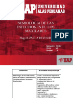 Semiología de las infecciones maxilares