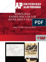 Semiologia Radiologica de Los Maxilares