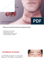 Bocio Nodulos Endocrinologia