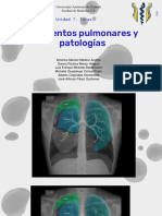 6.1 Segmentos Pulmonares