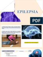 Epilepsia