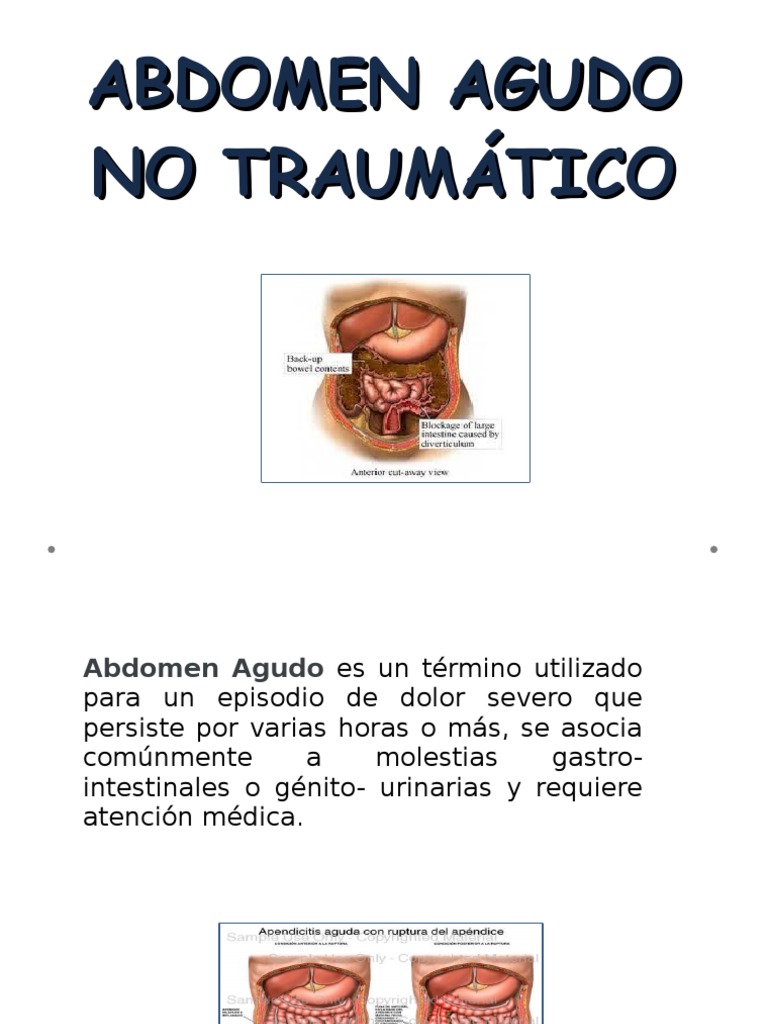 Abdomen Agudo No Traumatico PDF Abdomen Gastroenterología