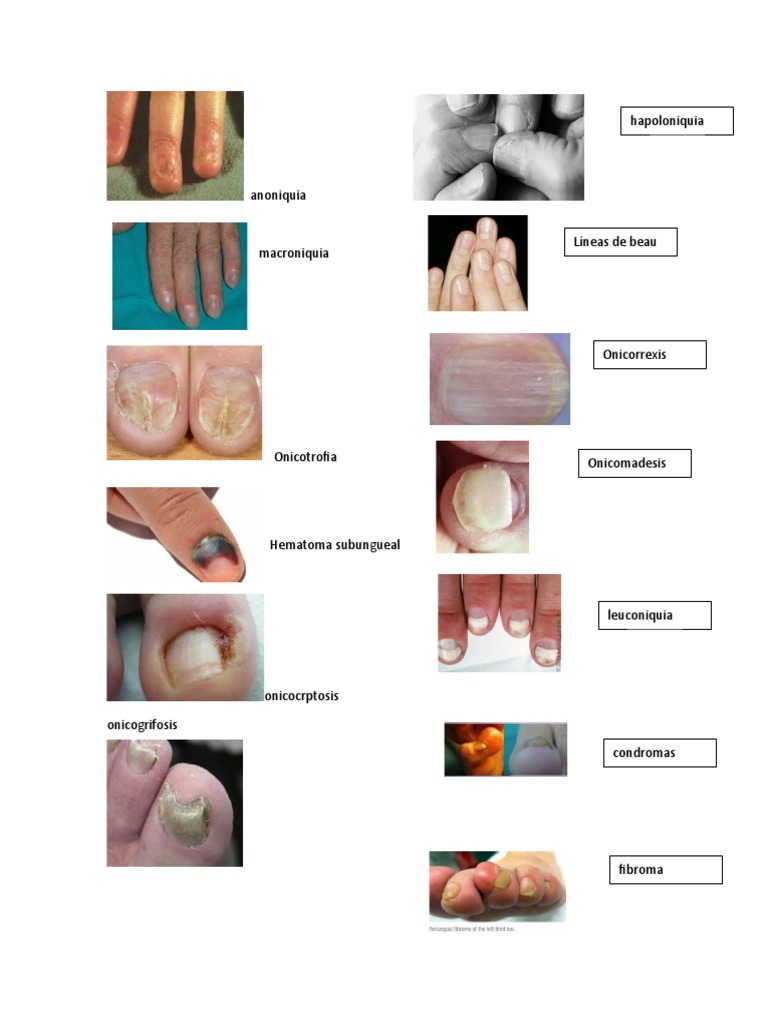 Podologia Imagenes | PDF