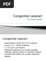 Congnital Cataract