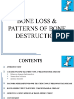 Bone Loss Patterns & Periodontal Disease