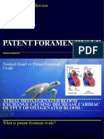 Patent Foramen Ovale