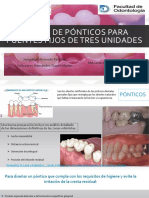 Diseño de Ponticos para Puentes Fijos de Tres Unidades