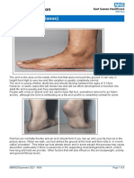 Flat Feet (Pes Planus) : What Is A Flat Foot?