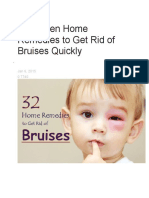 32 Proven Home Remedies To Get Rid of Bruises Quickly