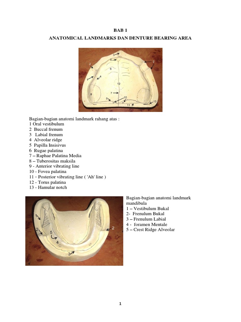 Anatomical Landmarks dan Area Gigi Tiruan | PDF