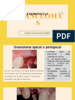 Granuloma apical: causas, síntomas y tratamiento