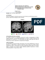 Lesiones cerebrales y sus afectaciones