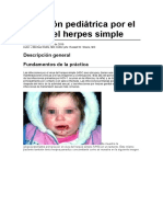 Herpes simple