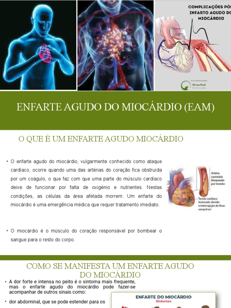 Sintomas e Fatores de Risco do Infarto | PDF | Infarto do Miocárdio ...