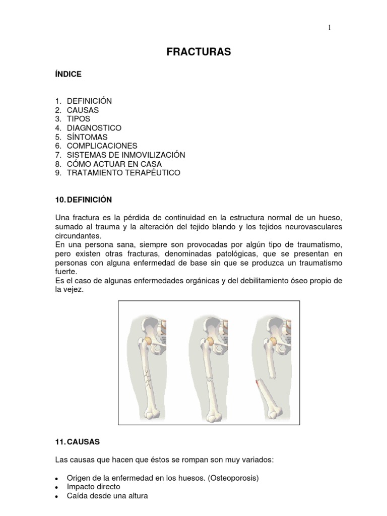Guía Completa sobre Fracturas Óseas | PDF | Lesión | Hueso