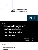 Semana 11-Fisiopatología en Enfermedades Cardiacas Más Comunes.