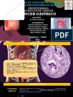 Cáncer gástrico: factores de riesgo, síntomas y complicaciones