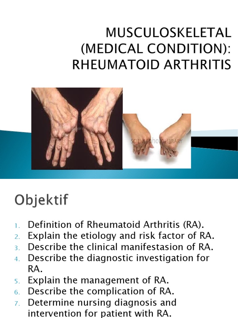 LP Rheumatoid Arthritis | PDF