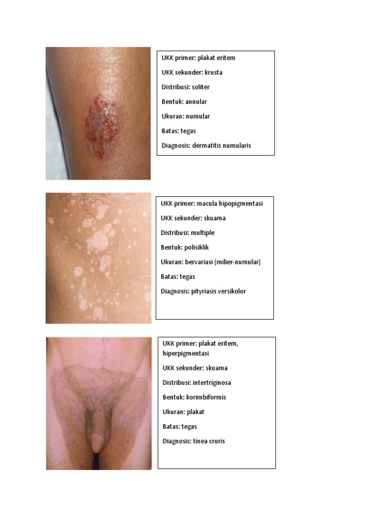 Barbara xonimning fetshi