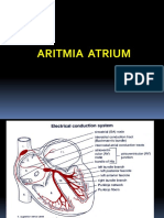 (DR - Furqon) Aritmia Atrium