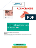 Adenomiosis