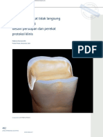 Posterior Indirect Adhesive Restorations - En.id - En.id