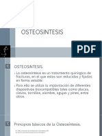 Fijación interna de fracturas: Osteosíntesis con implantes