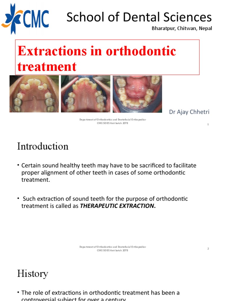 Therapeutic Extractions in Orthodontics | PDF | Orthodontics | Dental ...