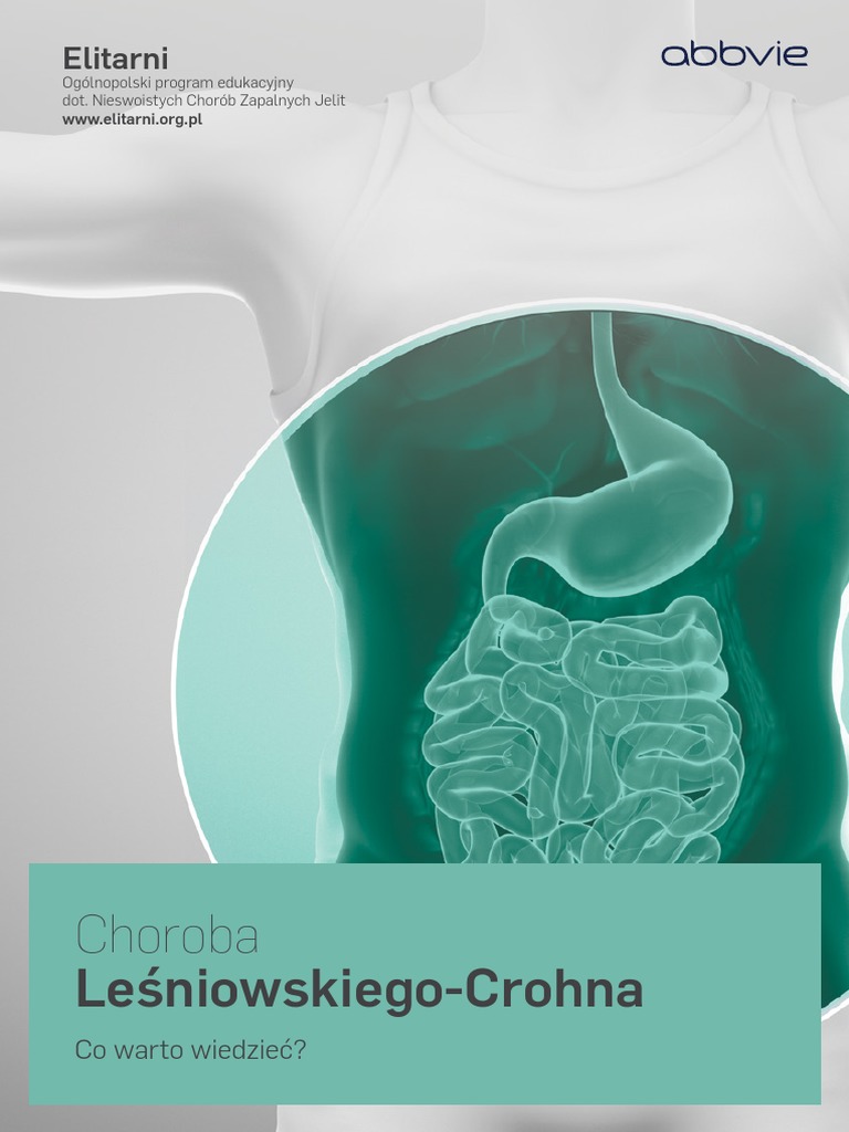 Choroba Leśniowskiego Crohna Co Warto Wiedzieć PDF