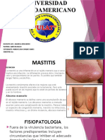 Mastitis y absceso mamario: causas, síntomas y tratamiento