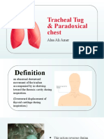 Tracheal Tug - Paradoxical Chest Movement